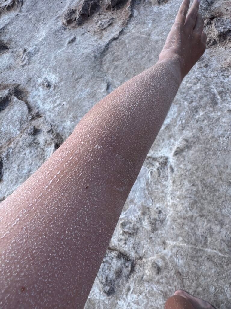 Arm covered in salt